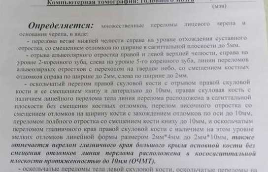 Новини Вінниці / На Вінниччині жорстоко побили юнака: в громаді збирають кошти на його порятунок