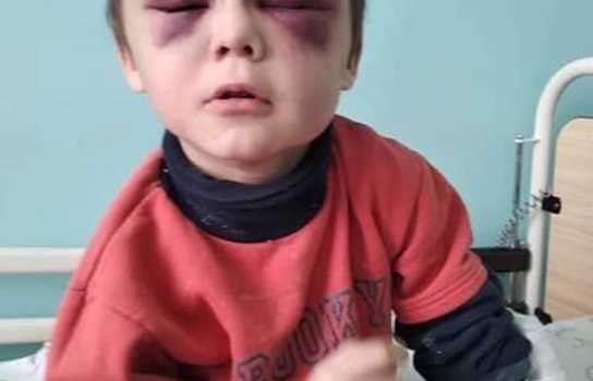 Новини Вінниці / На Вінниччині до в’язниці відправили жінку, яка катувала свого 6-річного пасинка