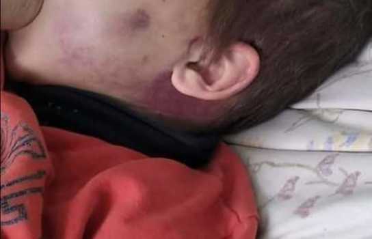 Новини Вінниці / На Вінниччині до в’язниці відправили жінку, яка катувала свого 6-річного пасинка