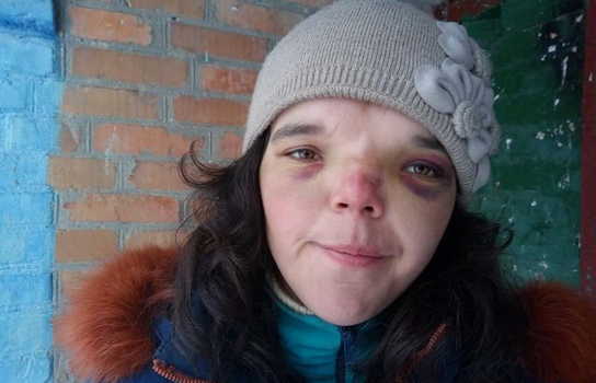 Новини Вінниці / На Вінниччині до в’язниці відправили жінку, яка катувала свого 6-річного пасинка