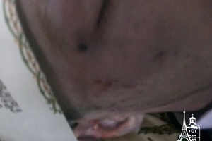 Новини Вінниці / Рідні строковика з Вінниччини не вірять в «нещасний» випадок – обличчя хлопця вкрито гематомами (ФОТО)