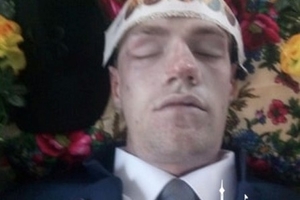 Новини Вінниці / Рідні строковика з Вінниччини не вірять в «нещасний» випадок – обличчя хлопця вкрито гематомами (ФОТО)