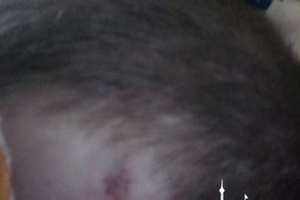 Новини Вінниці / Рідні строковика з Вінниччини не вірять в «нещасний» випадок – обличчя хлопця вкрито гематомами (ФОТО)