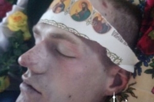 Новини Вінниці / Рідні строковика з Вінниччини не вірять в «нещасний» випадок – обличчя хлопця вкрито гематомами (ФОТО)