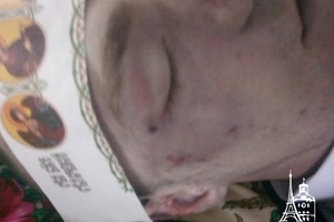 Новини Вінниці / Рідні строковика з Вінниччини не вірять в «нещасний» випадок – обличчя хлопця вкрито гематомами (ФОТО)