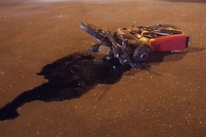 Новини Вінниці / ДТП з мотоциклом та двома автівками у Вінниці: лікарі рятують мотоцикліста (ФОТО, ВІДЕО) 