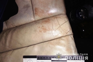 Новини Вінниці / Злочин через ревнощі: у Бершадському районі на Вінниччині жорстоко били й катували 24-річного хлопця (ФОТО)