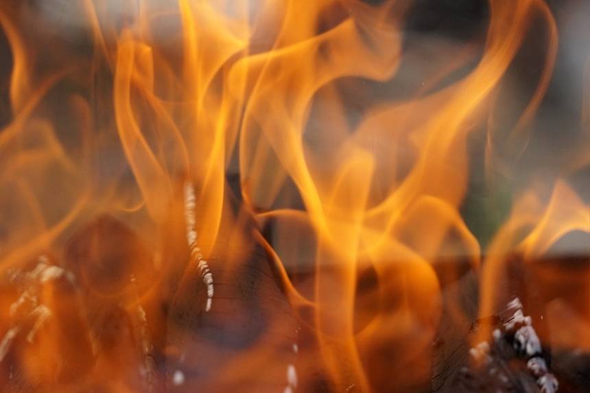 Новини Вінниці / У пожежі на Вінниччині важко травмовано дворічного малюка: у дитини 90% опіків тіла