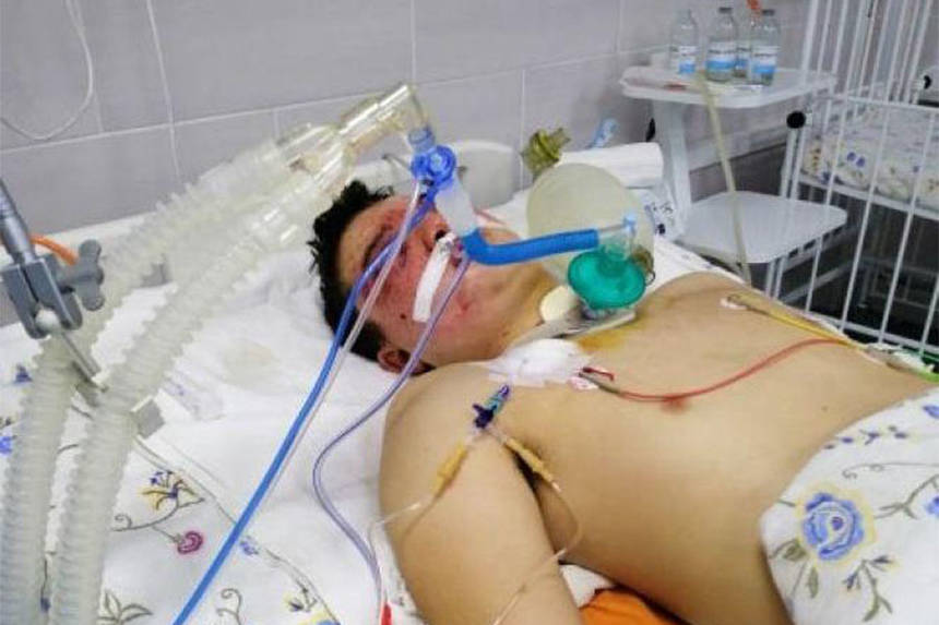 Новини Вінниці / На Вінниччині жорстоко побили юнака: в громаді збирають кошти на його порятунок