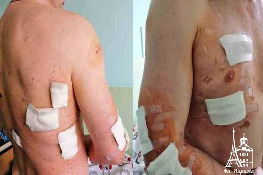 Новини Вінниці / У Вінниці суд виніс вирок чоловікові, який навесні впритул стріляв у музиканта в ресторані 