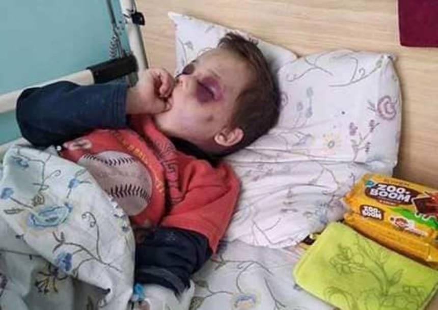 Новини Вінниці / На Вінниччині до в’язниці відправили жінку, яка катувала свого 6-річного пасинка