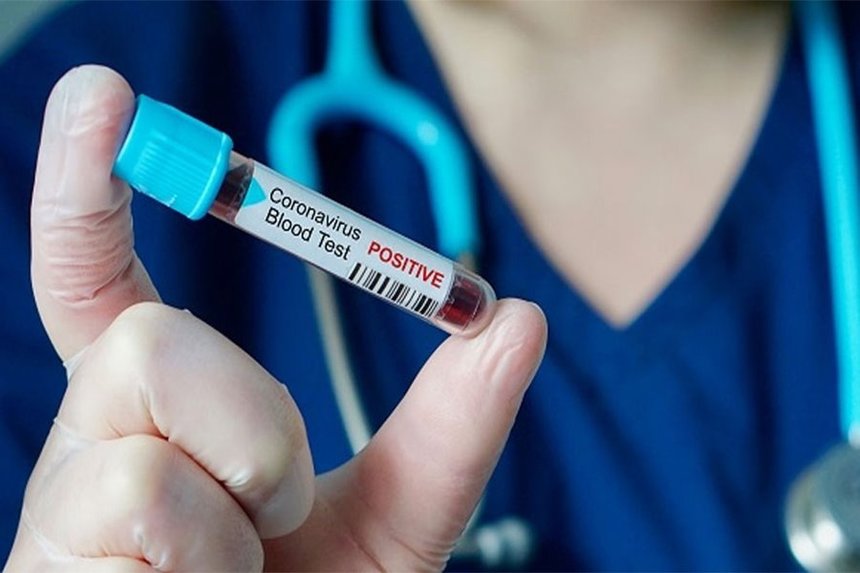 Новини Вінниці / Дев'ять нових випадків коронавірусу підтвердили сьогодні на Вінниччині: загалом в області 32 хворих 