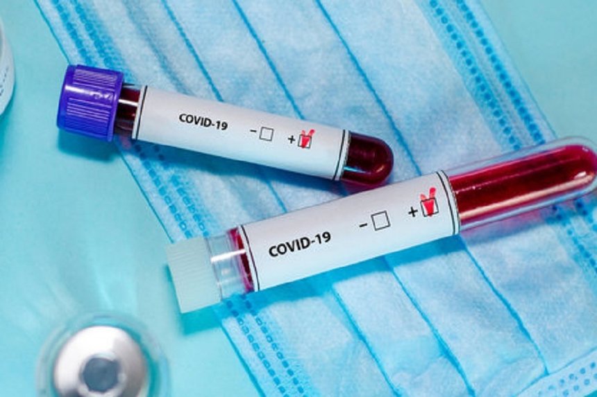 Новини Вінниці / Перший випадок зараження коронавірусом підтвердили у Ямполі на Вінниччині 