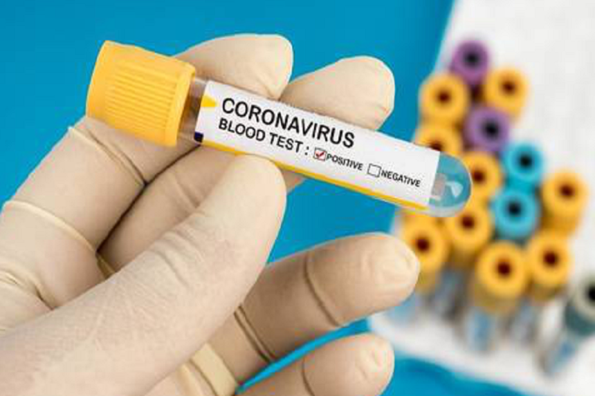 Новини Вінниці / Дев'ять за добу: на Вінниччині підтверджено 75 випадків коронавірусу