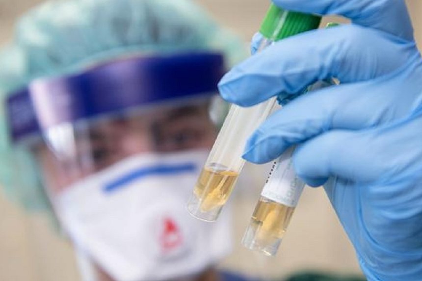 Коронавірус не відступає: на Вінниччині 23 нових випадки за добу / Новости Винницы и области / Інформаційний портал На Париже Новини Вінниці / Коронавірус не відступає: на Вінниччині 23 нових випадки за добу