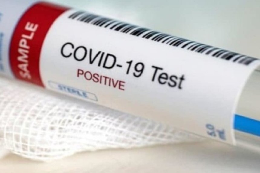 Новини Вінниці / Темпи не спадають: за добу на Вінниччині виявлено 35 нових випадків коронавірусу