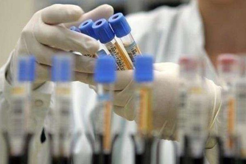 Новини Вінниці / Минулої доби на Вінниччині жоден медпрацівник не "підхопив" коронавірус. Де в області виявляли нові випадки хвороби 