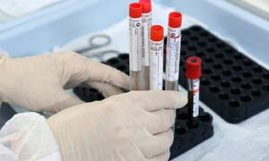 Новини Вінниці / Вісьмом вінничанам діагностували Сovid-19, стільки ж інфікованих виявили в п‘яти районах області