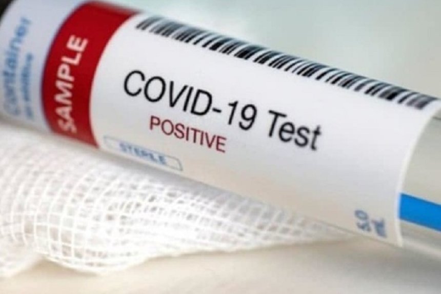 Новини Вінниці / Де на Вінниччині минулої доби фіксували найбільше випадків коронавірусу 