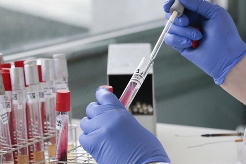 Кількість хворих на коронавірус на Вінниччині зростає: за добу виявлено 37 нових випадків / Новости Винницы и области / Інформаційний портал На Париже Новини Вінниці / Кількість хворих на коронавірус на Вінниччині зростає: за добу виявлено 37 нових випадків