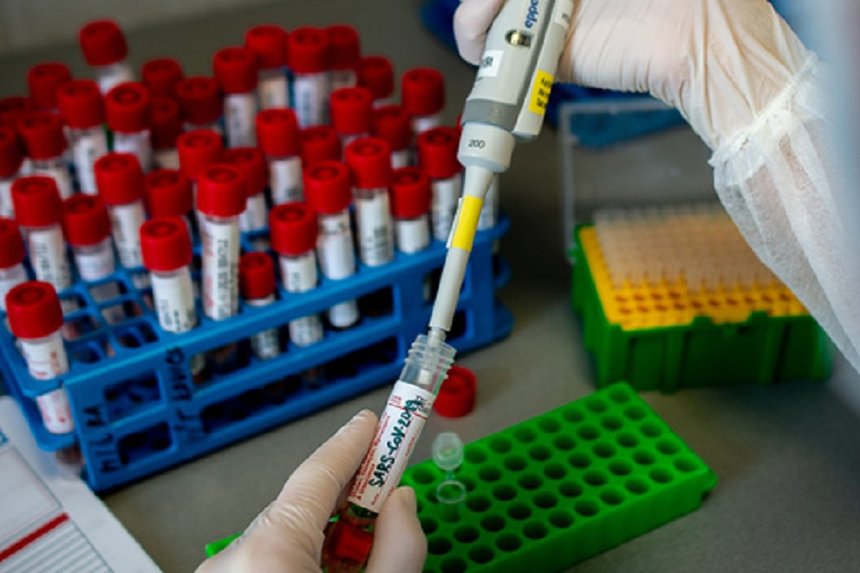 Новини Вінниці / На Вінниччині вже зробили понад 50 тисяч ПЛР-тестів на COVID-19: де фіксували хворобу минулої доби 