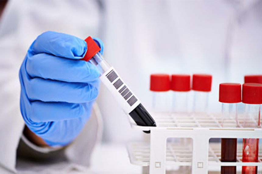 Новини Вінниці / На Вінниччині знижується кількість нових випадків COVID-19