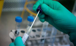 Новини Вінниці / Спалах коронавірусу виявлено у Могилів-Подільському районі, а у Вінниці померло двоє хворих 