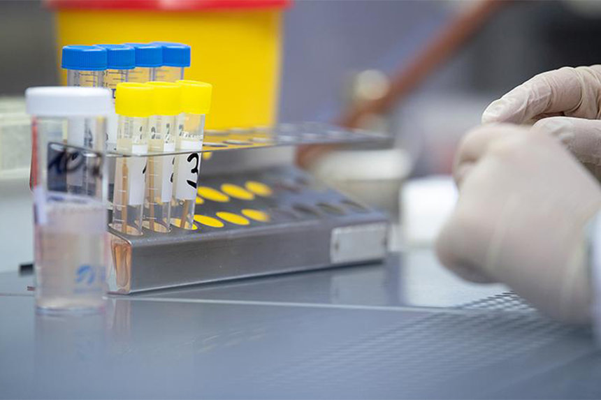 Коронавірус у Вінниці за минулу добу виявлено у 17 людей / Новости Винницы и области / Інформаційний портал На Париже Новини Вінниці / Коронавірус у Вінниці за минулу добу виявлено у 17 людей