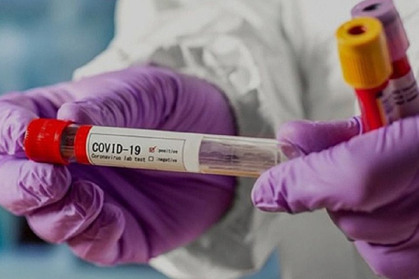 Майже половина виявлених в області випадків COVID-19 припадає на Вінницю / Новости Винницы и области / Інформаційний портал На Париже Новини Вінниці / Майже половина виявлених в області випадків COVID-19 припадає на Вінницю