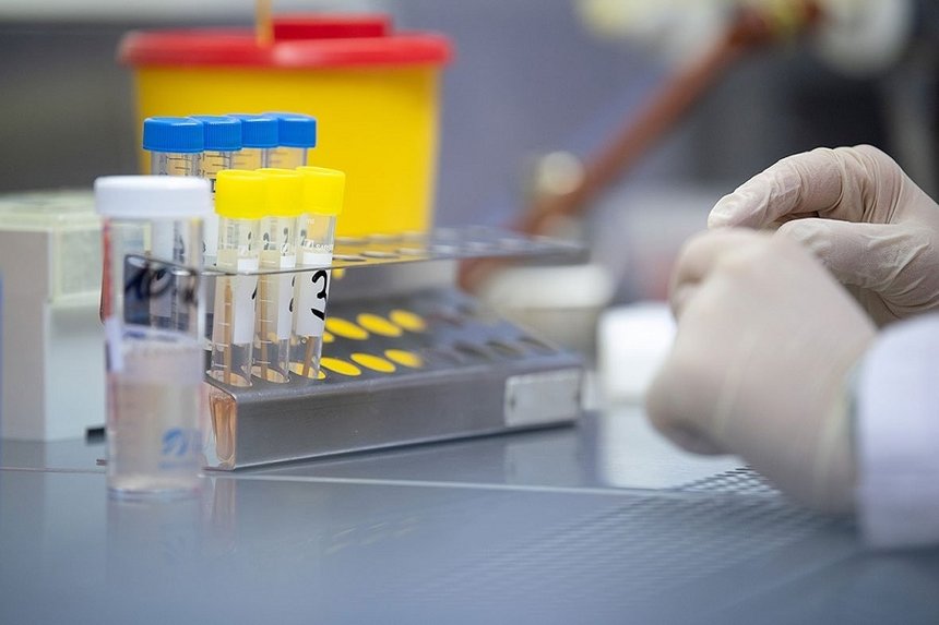 Новини Вінниці / Де на Вінниччині минулої доби фіксували коронавірус 