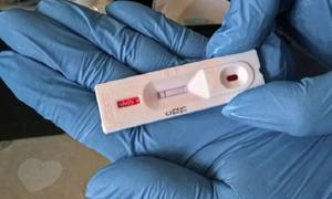 Новини Вінниці / Кількість нових випадків COVID-19 на Вінниччині знову зросла: за добу виявлено 75 хворих