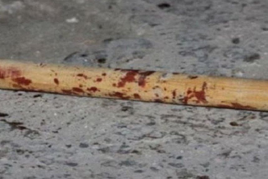 Новини Вінниці / Бив палицею по голові: після застілля у Жмеринському районі на Вінниччині госпіталізовано 40-річного чоловіка