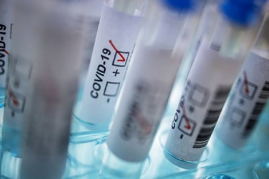 Новини Вінниці / Де на Вінниччині минулої доби фіксували найбільше нових випадків коронавірусу 