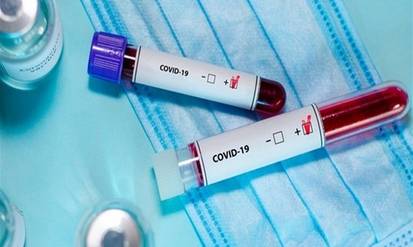 На Вінниччині знову зросла кількість хворих на Сovid-19 / Новости Винницы и области / Інформаційний портал На Парижі Новини Вінниці / На Вінниччині знову зросла кількість хворих на Сovid-19