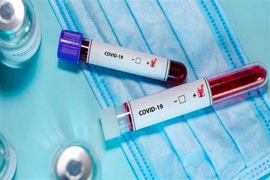 Новини Вінниці / На Вінниччині знову зросла кількість хворих на Сovid-19