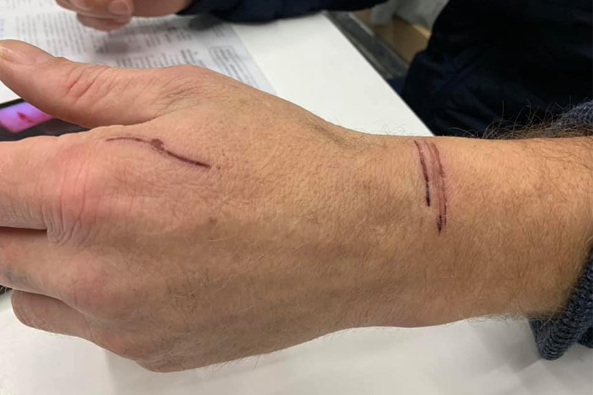 Новини Вінниці / У Вінниці відмовили у запобіжному заході для атовця-інваліда, який нібито вдарив поліцейського