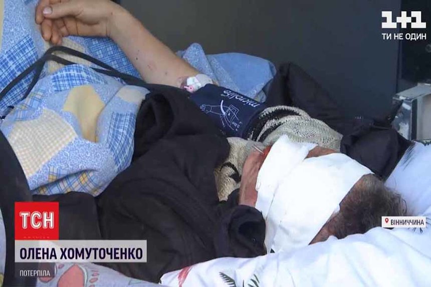 Новини Вінниці / На Вінниччині знайшли пошматованою жінку, яка доглядала за безпритульними собаками (ВІДЕО)