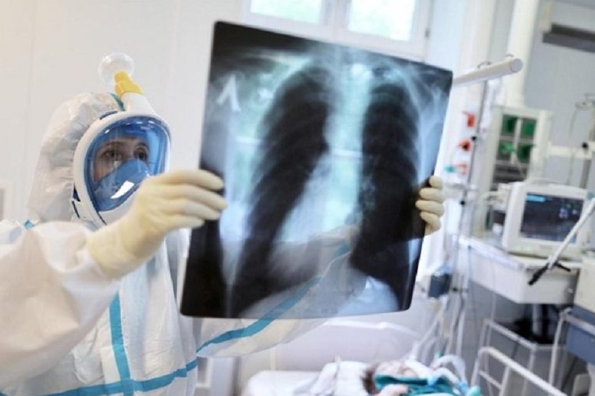 Новини Вінниці / На Вінниччині черговий антирекорд: за добу виявлено 600 нових випадків COVID-19, померло 10 людей 