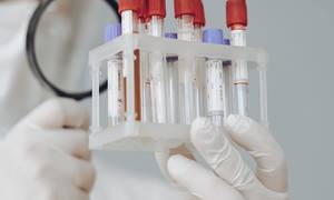 Новини Вінниці / Вінниччина вийшла на перше місце в Україні за добовим показником захворюваності на COVID-19