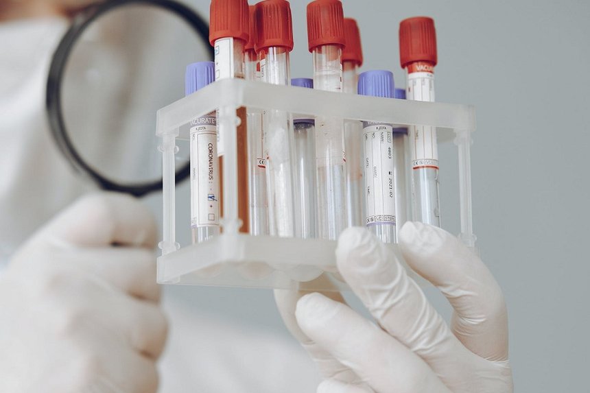 Вінниччина вийшла на перше місце в Україні за добовим показником захворюваності на COVID-19 / Новости Винницы и области / Інформаційний портал На Париже Новини Вінниці / Вінниччина вийшла на перше місце в Україні за добовим показником захворюваності на COVID-19